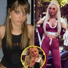 Loredana chivu, loredana chivu buze, loredana chivu operatii estetice, operatii estetice vedete. Facebook