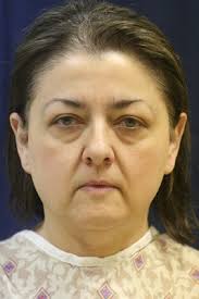 World-Renowned Plastic Surgeon, Dr. Michael Byun Proves His Unique Approach  "Byun Method," an Innovative, More Natural Looking Alternative to a  Traditional Face Lift