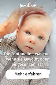 Die Fontanelle Was Tun Wenn Sie Gewolbt Oder Eingesunken Ist Familie De Baby Erziehung Kinderkrankheiten Sauglinge