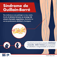 Sindrome De Guillain Barre