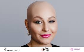 Time to Kiss Cancer Goodbye at This Montreal Fundraiser