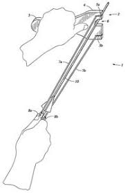 Slingshots are versatile little devices. Slingshot Arrows Arms Defense Etc