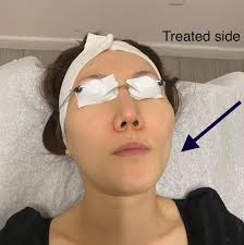 BAIRE-Hair Removal, Lashes,Brows,Facials