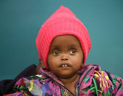 Success! Caleb from Kenya raised $805 for spina bifida closure surgery.