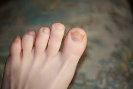 How To Clear Up Dark Toenails This step will prevent your skin from becoming irritated by the.