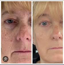 Jeffries Eye Care (@jeffrieseyecare) • Facebook