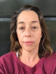 Taking voodoo classes to go bald