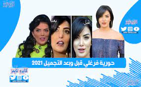 وقالت حورية إنه بعد وفاة خطيبها، ضغطت عليها والدتها كي تخطب، فخطبت حورية وتزوجت لمدة ثلاثة أشهر فقط. Ø­ÙˆØ±ÙŠØ© ÙØ±ØºÙ„ÙŠ Ù‚Ø¨Ù„ ÙˆØ¨Ø¹Ø¯ Ø§Ù„ØªØ¬Ù…ÙŠÙ„ 2021 ÙƒØ§ÙŠØ±Ùˆ ØªØ§ÙŠÙ…Ø²