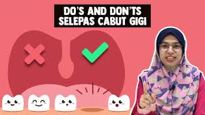 Untuk menjawab pertanyaan ini, yuk simak penjelasan hukum sikat gigi. Do S And Don Ts Selepas Cabut Gigi Youtube