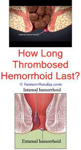 We did not find results for: Madison Healthcare After Hemorrhoid Surgery