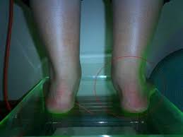 Check spelling or type a new query. Posterior Tibial Tendon Dysfunction My Footdr