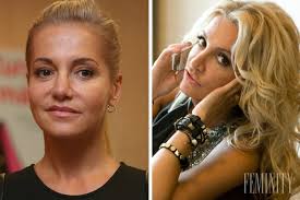 , plasticka operace ocnich vicek kolik stoji plastika vazu plasticke operace v opava, karlovy vary, decin, teplice. Nenalicena Dara Rolins A S Dokonalou Vizazou Pozrite Si Tie Najuletenejsie Variacie Jej VzhÄ¾adu Feminity Sk