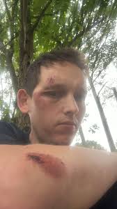 Motorcycle and Car Accidents in Rockford IL, Safety Concerns