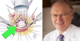 Modified David Reimplantation Procedure: What Should Patients Know?