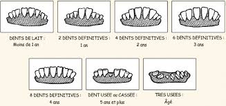 La chute des dents définitives est la. Bases A Connaitre