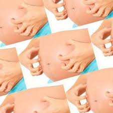 Scabies In Pregnancy What To Know Drscabies