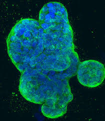 New Discovery: Small molecule 5D4 emerges as a promising disruptor of multiple cancer pathways