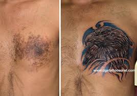 Back Birthmark Cover Up Tattoo Eagle Tattoo Covering A Birthmark Cover Tattoo Tattoos Cover Up Tattoos