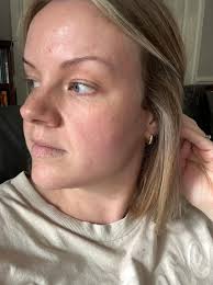 Best Aesthetic Treatment Clinic in Liverpool