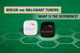 A lung tumor is an abnormal rate of cell division or cell death in lung tissue or in the airways that lead to the lungs. Benign And Malignant Tumors What Is The Difference