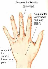 Pin On What Acupuncture Can Do For You