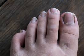 nail abnormalities causes symptoms and pictures