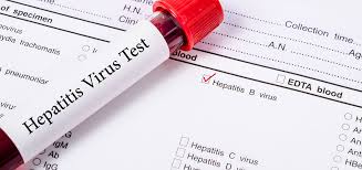 There are 3 parts to the hepatitis b panel of blood tests, so understanding your test results can be confusing. Hepatitis Urologe Und Androloge Urologische Praxis Prof Dr Porst