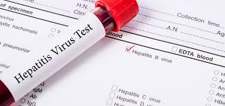 Eine impfung bietet auch jugendlichen schutz, deren infektionsrisiko höher ist. Hepatitis Urologe Und Androloge Urologische Praxis Prof Dr Porst