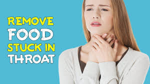 Food stuck in throat won't go down. What Do You Do When You Have Food Stuck In Your Throat Safe Natural In Telugu By Telugu Health Plus All In One