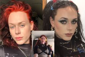 Translytei „Tik Tok“ žvaigždei lyties keitimo operacija atlikta surinkus  pinigus iš sekėjų: esu labai privilegijuota