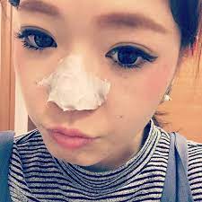 昔からニキビや怪我の治療で大活躍していたオロナイン そのオロナインでパックすると毛穴の黒ずみが消えてしまうってしっていましたか イチゴ鼻に効果的な オロナインパックのやり方をまとめました イチゴ鼻 いちご鼻 オロナイン 毛穴パック