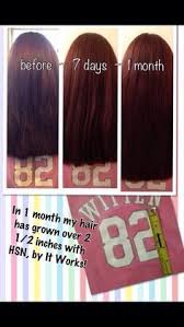 Can You Make Hair Grow Faster How You Make Your Hair Grow Faster Hair Growth Pills Grow Hair Faster Diy Make Hair Grow Faster