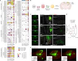 Brain-wide neuronal circuit connectome of human glioblastoma | Nature