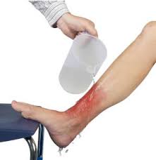 How to treat hot water burn. St John First Aid Guide On How To Treat Burns