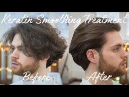This is your typical male pattern baldness: Keratin Smoothing Straightening Treatment On Men S Hair Review Youtube