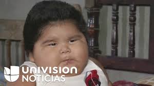 El extraño caso de Luis Manuel, un bebé mexicano que pesa casi 30 kilos