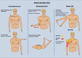 Image result for Shoulder Exam