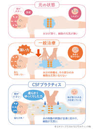 カイロプラクティック