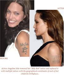 Maybe you would like to learn more about one of these? Removing Unwanted Tattoos