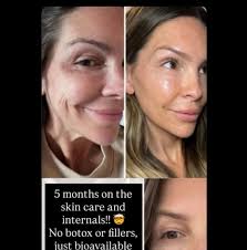 Chelsey Smotherman added a new photo.