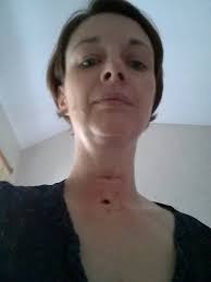 Jacqui's reconstruction