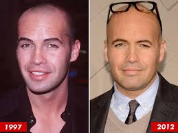 Billy Zane: Good Genes or Good Haircut?