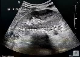 An external file that holds a picture, illustration, etc. Abdomensonographie Bauch Ultraschall Praktischarzt