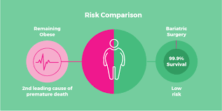 Safety And Risks Of Bariatric Surgery Weightwise