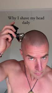 Transforming Alopecia with Scalp Micropigmentation