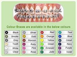 Hopefully Some These Colors Are My Choices At My Orthodontist When I Am Getting Apocalypse Now And Then Braces Colors Braces Braces Tips