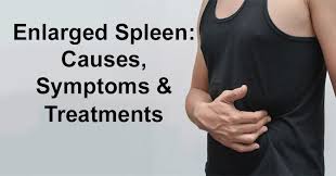 When spleen enlargement is associated with a change in splenic function, it is most frequently associated with splenic patients may complain of pain in the left upper abdomen or referred pain in the left shoulder. Pin On Diseases Treatments
