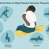 Image result for icd 10 code for lumbar annular tear