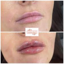 Aesthetics by Amber-Rose