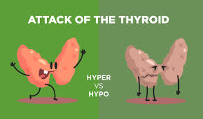 Para pesakit gout, baca ini agar tak kena kajian saintifik menunjukkan bahawa gaya pemakanan adalah antara faktor utama penyebab kepada penyakit gout serta masalah kesihatan yang lain. Set Tiroid Shaklee Pengedar Shaklee Shah Alam